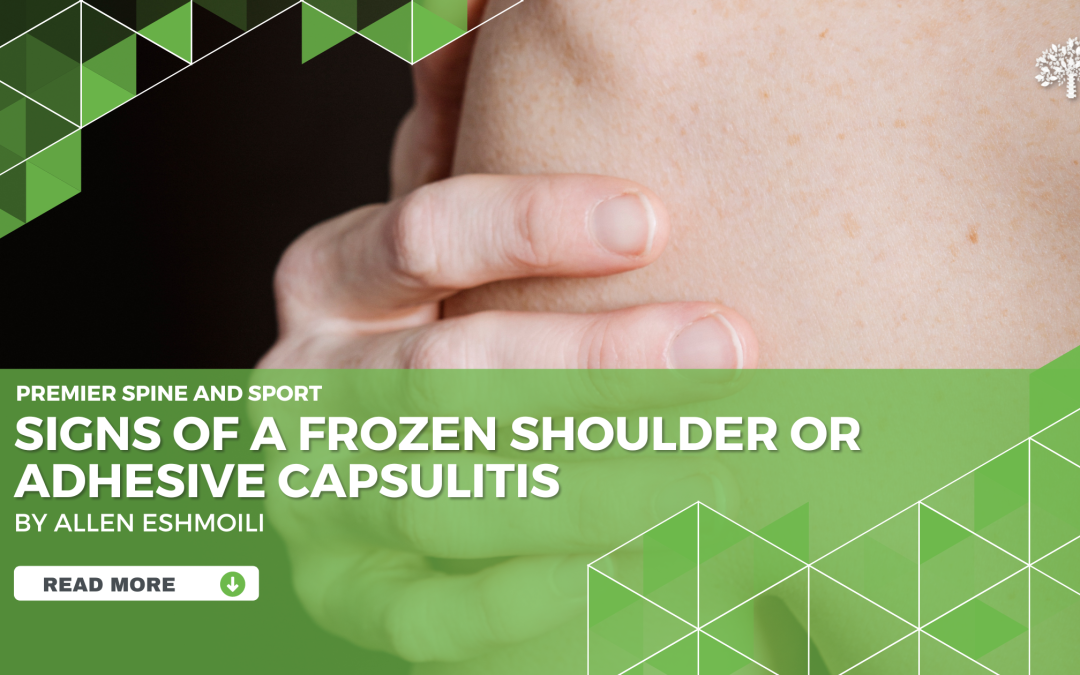 Signs of a Frozen Shoulder or Adhesive Capsulitis