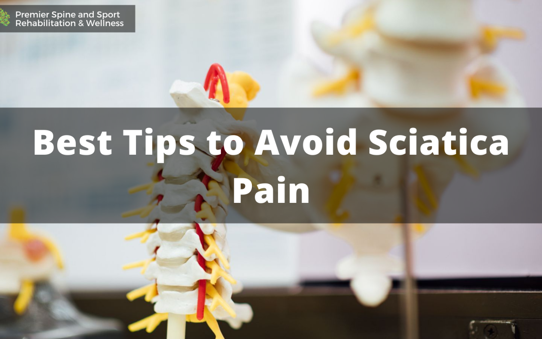 Best Tips to Avoid Sciatica Pain